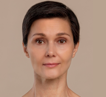 1690279037_After Botox.png